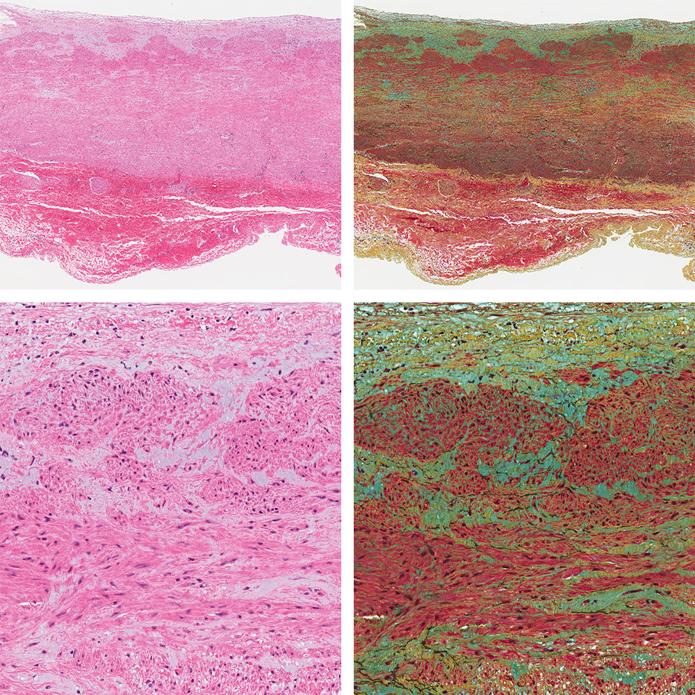 e-heart.org Cardiovascular Pathology Home Page